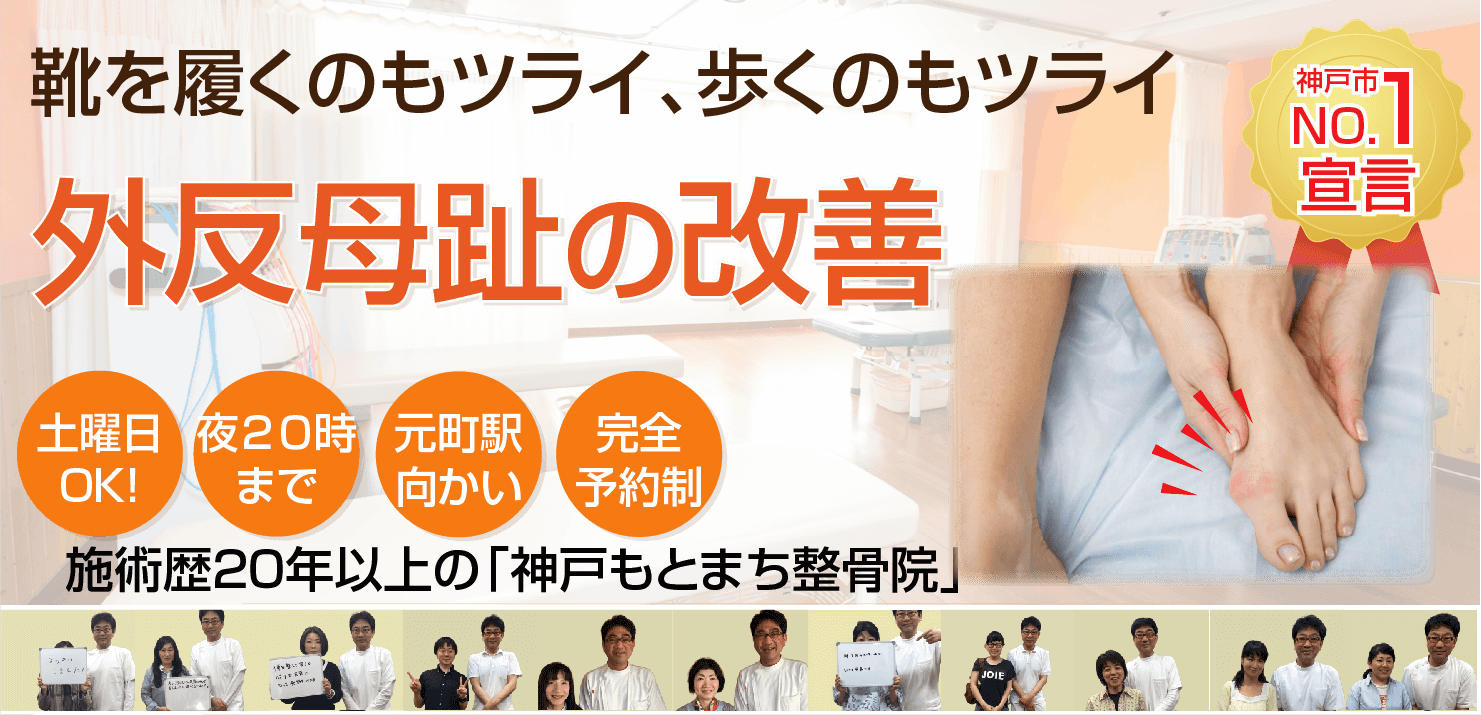 外反母趾でお悩みの方へ 神戸もとまち整骨院