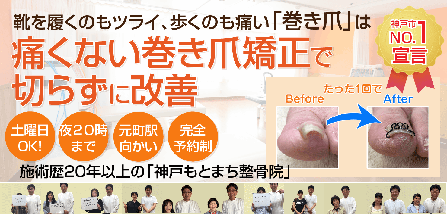 巻き爪でお悩みのあなたへ